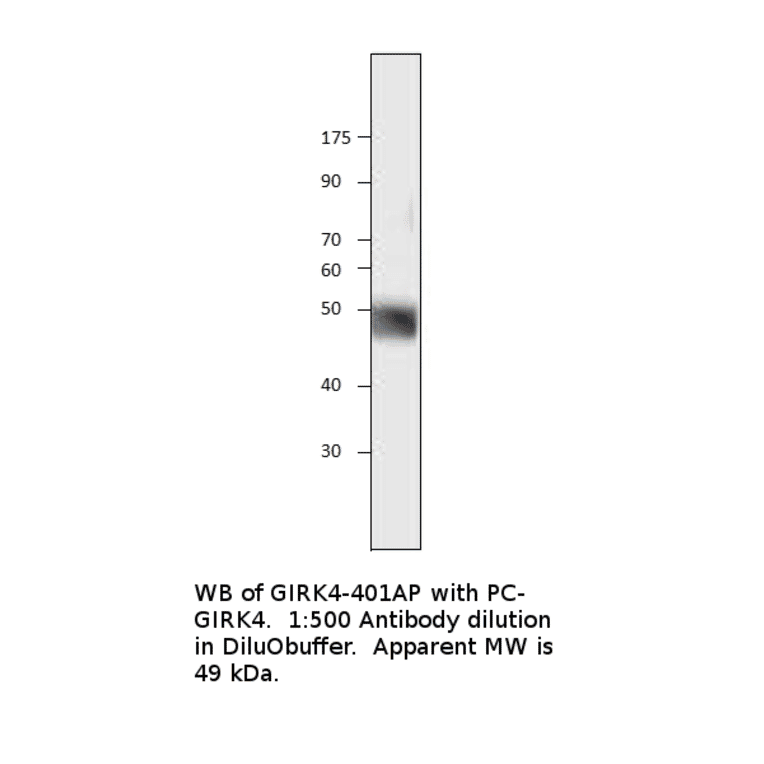 Anti-KCNJ5 Antibody from FabGennix (GIRK4-401AP) - Antibodies.com