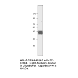 Anti-KCNJ5 Antibody from FabGennix (GIRK4-401AP) - Antibodies.com