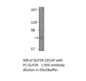 Anti-GLP2R Antibody from FabGennix (GLP2R-201AP) - Antibodies.com