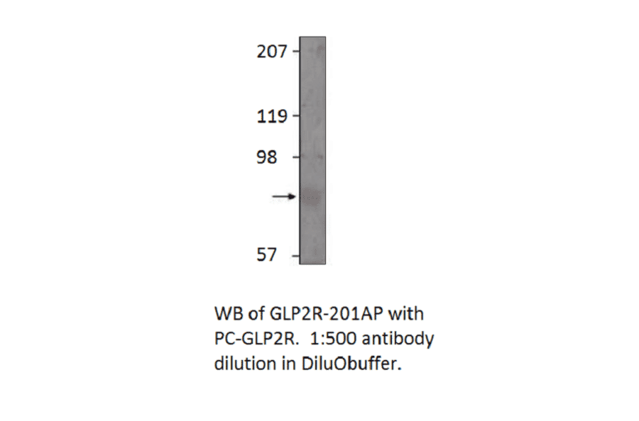 Anti-GLP2R Antibody from FabGennix (GLP2R-201AP) - Antibodies.com