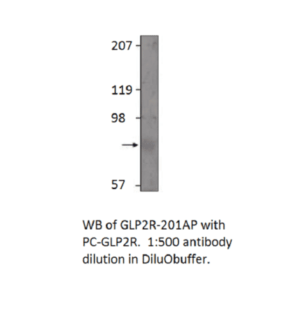 Anti-GLP2R Antibody from FabGennix (GLP2R-201AP) - Antibodies.com