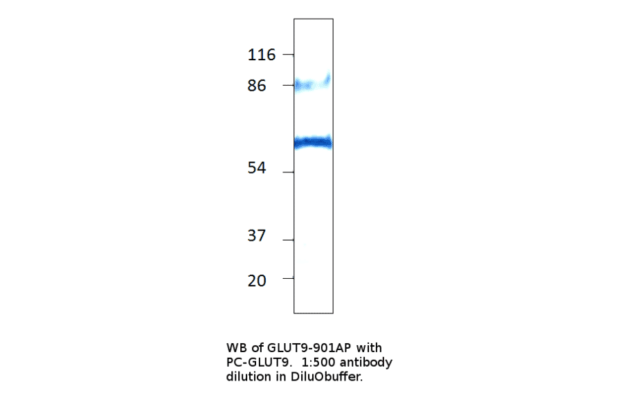 Anti-GLUT9 Antibody from FabGennix (GLUT9-901AP) - Antibodies.com