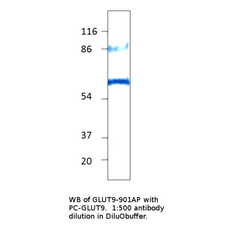 Anti-GLUT9 Antibody from FabGennix (GLUT9-901AP) - Antibodies.com