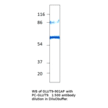 Anti-GLUT9 Antibody from FabGennix (GLUT9-901AP) - Antibodies.com