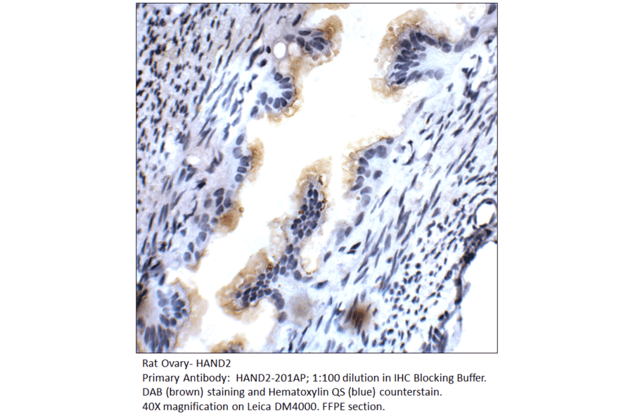 Anti-HAND2 Antibody from FabGennix (HAND2-201AP) - Antibodies.com