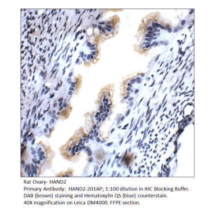 Anti-HAND2 Antibody from FabGennix (HAND2-201AP) - Antibodies.com