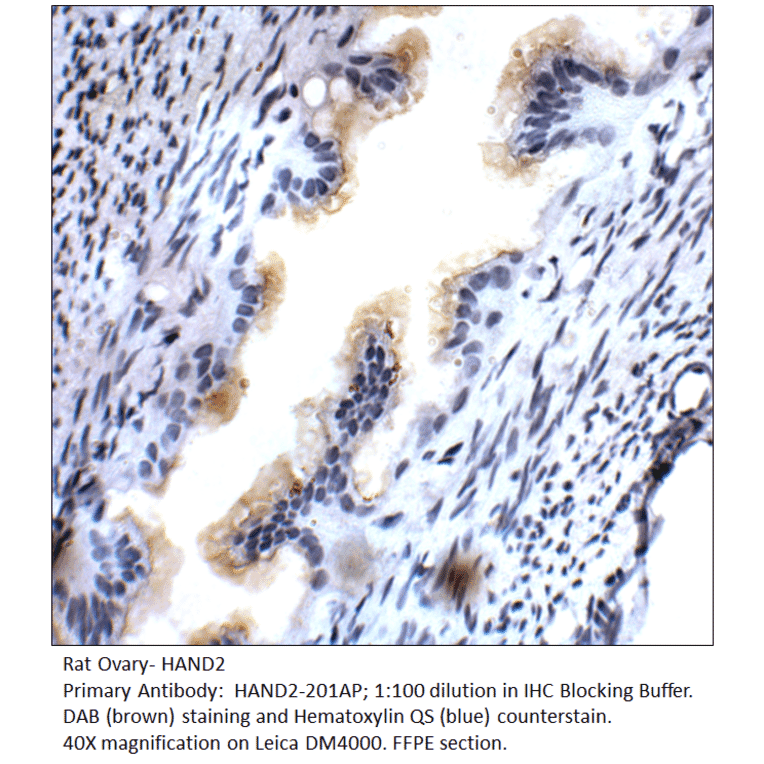 Anti-HAND2 Antibody from FabGennix (HAND2-201AP) - Antibodies.com