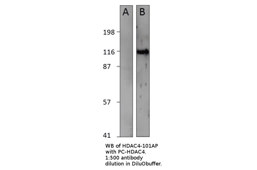 Anti-HDAC4 Antibody from FabGennix (HDAC4-101AP) - Antibodies.com
