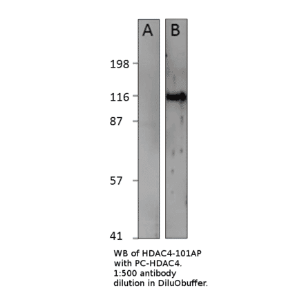 Anti-HDAC4 Antibody from FabGennix (HDAC4-101AP) - Antibodies.com