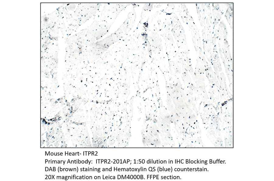 Anti-ITPR2 Antibody from FabGennix (ITPR2-201AP) - Antibodies.com