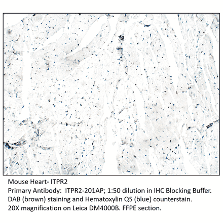 Anti-ITPR2 Antibody from FabGennix (ITPR2-201AP) - Antibodies.com