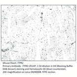 Anti-ITPR2 Antibody from FabGennix (ITPR2-201AP) - Antibodies.com