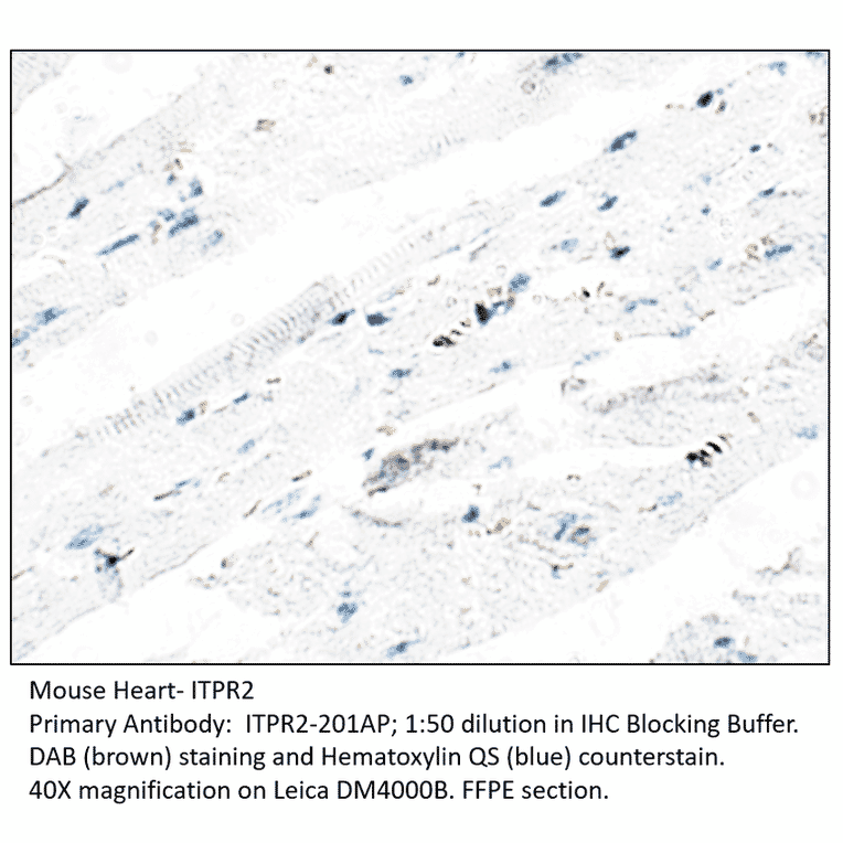 Anti-ITPR2 Antibody from FabGennix (ITPR2-201AP) - Antibodies.com