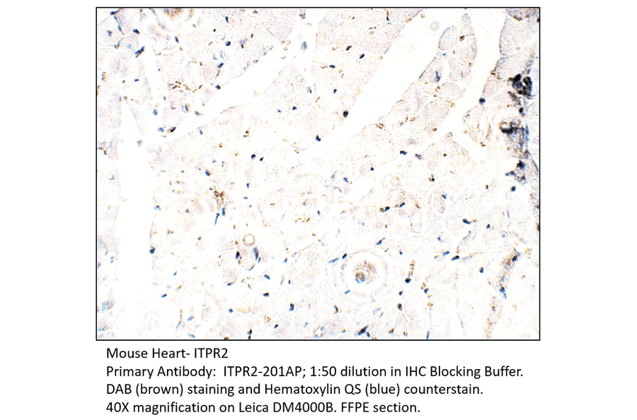 Anti-ITPR2 Antibody from FabGennix (ITPR2-201AP) - Antibodies.com