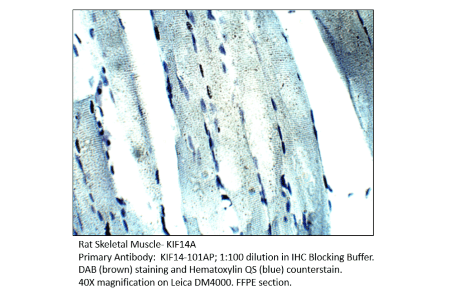 Anti-KIF14 Antibody from FabGennix (KIF14-101AP) - Antibodies.com
