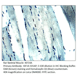 Anti-KIF14 Antibody from FabGennix (KIF14-101AP) - Antibodies.com