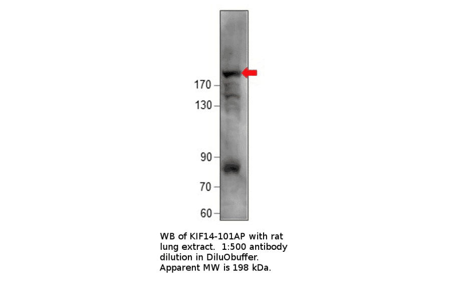 Anti-KIF14 Antibody from FabGennix (KIF14-101AP) - Antibodies.com