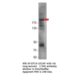 Anti-KIF14 Antibody from FabGennix (KIF14-101AP) - Antibodies.com