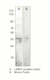 Anti-LAMP2 Antibody from FabGennix (LAMP2-201AP) - Antibodies.com