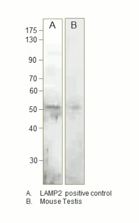 Anti-LAMP2 Antibody from FabGennix (LAMP2-201AP) - Antibodies.com