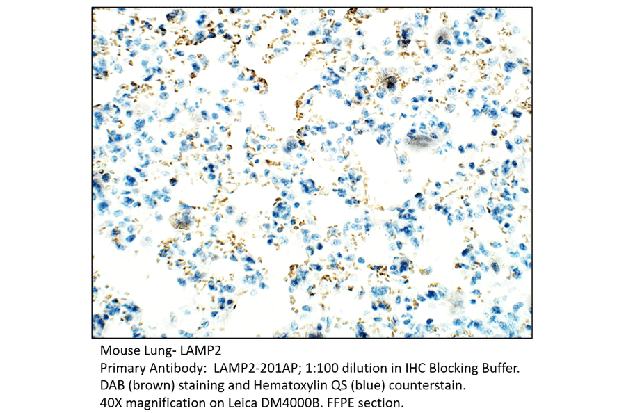 Anti-LAMP2 Antibody from FabGennix (LAMP2-201AP) - Antibodies.com