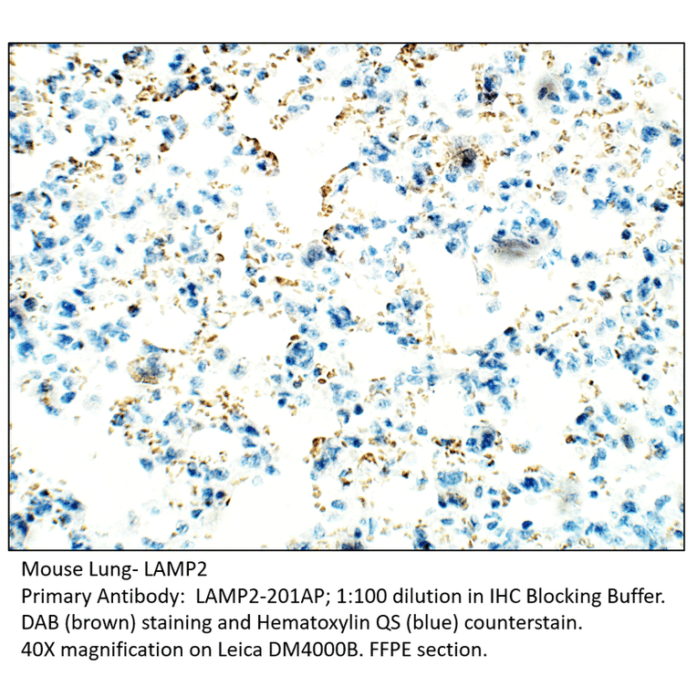 Anti-LAMP2 Antibody from FabGennix (LAMP2-201AP) - Antibodies.com