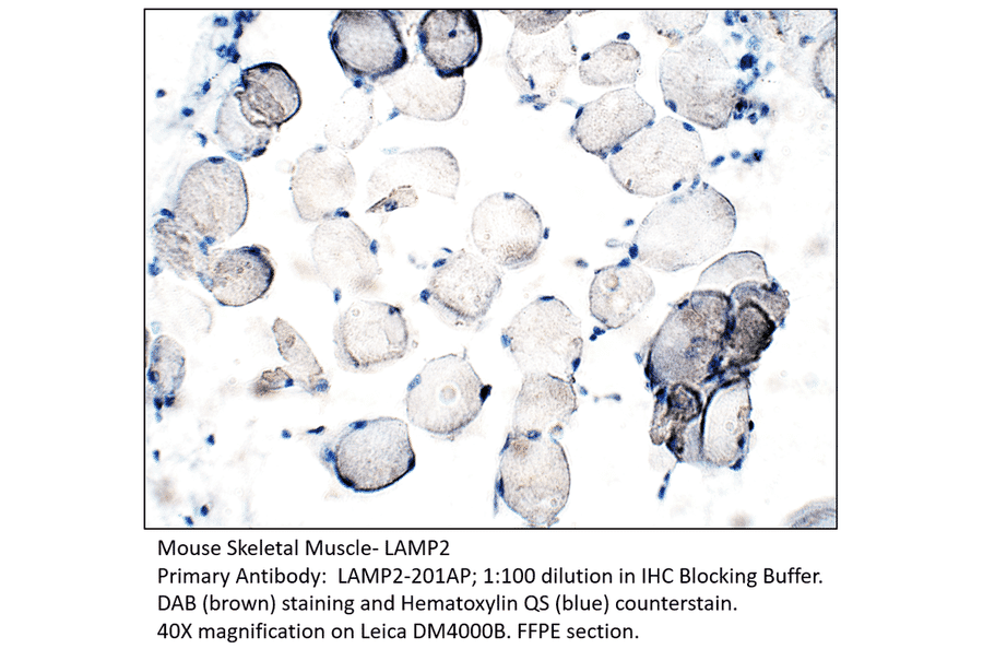 Anti-LAMP2 Antibody from FabGennix (LAMP2-201AP) - Antibodies.com
