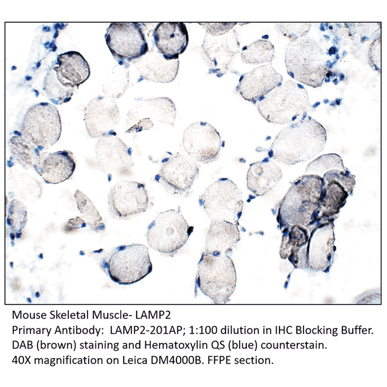 Anti-LAMP2 Antibody from FabGennix (LAMP2-201AP) - Antibodies.com