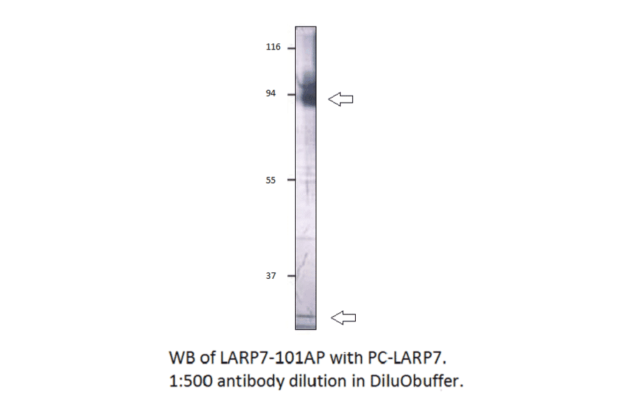 Anti-LARP7 Antibody from FabGennix (LARP7-701AP) - Antibodies.com