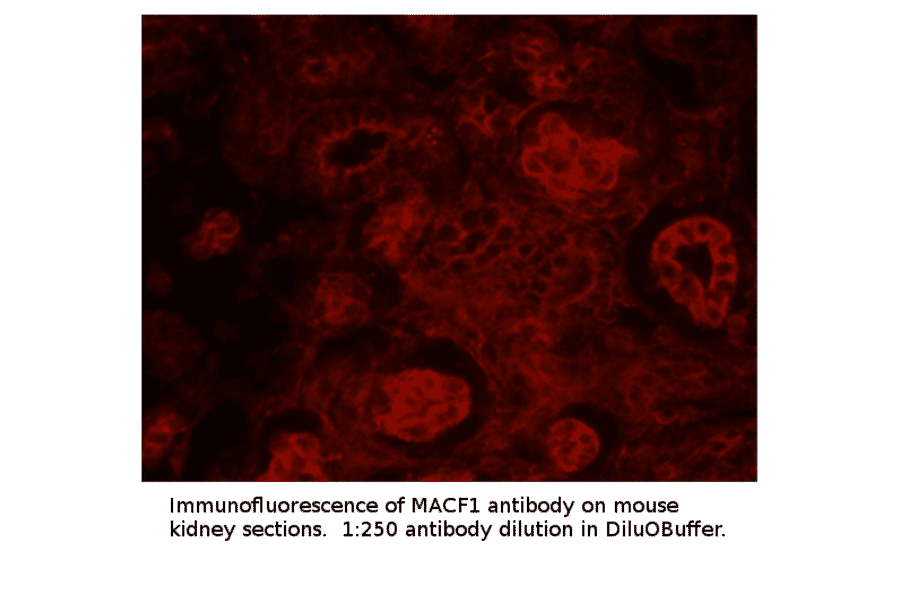 Anti-MACF1 Antibody from FabGennix (MACF1-101AP) - Antibodies.com