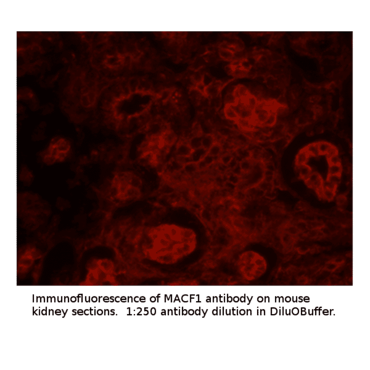 Anti-MACF1 Antibody from FabGennix (MACF1-101AP) - Antibodies.com