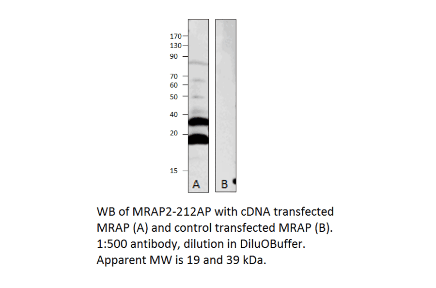Anti-MRAP2 Antibody from FabGennix (MRAP2-212AP) - Antibodies.com
