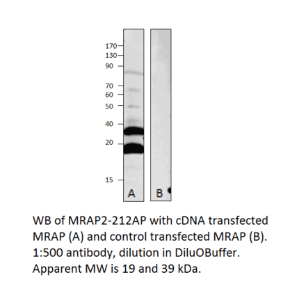 Anti-MRAP2 Antibody from FabGennix (MRAP2-212AP) - Antibodies.com