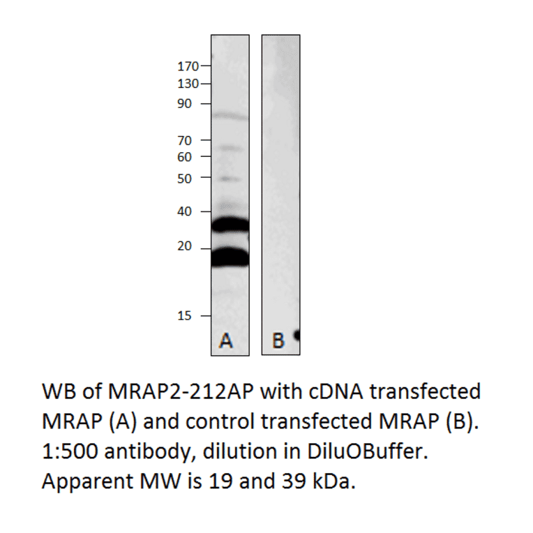 Anti-MRAP2 Antibody from FabGennix (MRAP2-212AP) - Antibodies.com