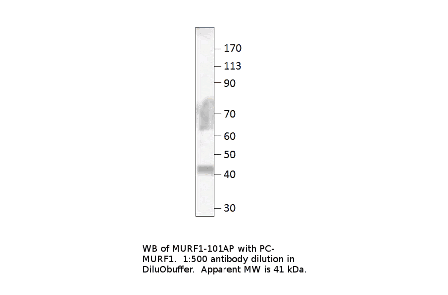 Anti-MURF1 Antibody from FabGennix (MURF1-101AP) - Antibodies.com