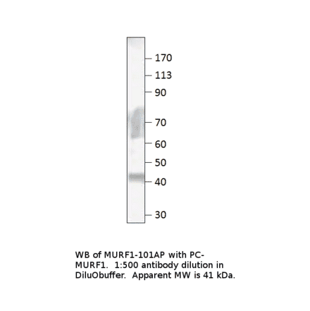 Anti-MURF1 Antibody from FabGennix (MURF1-101AP) - Antibodies.com