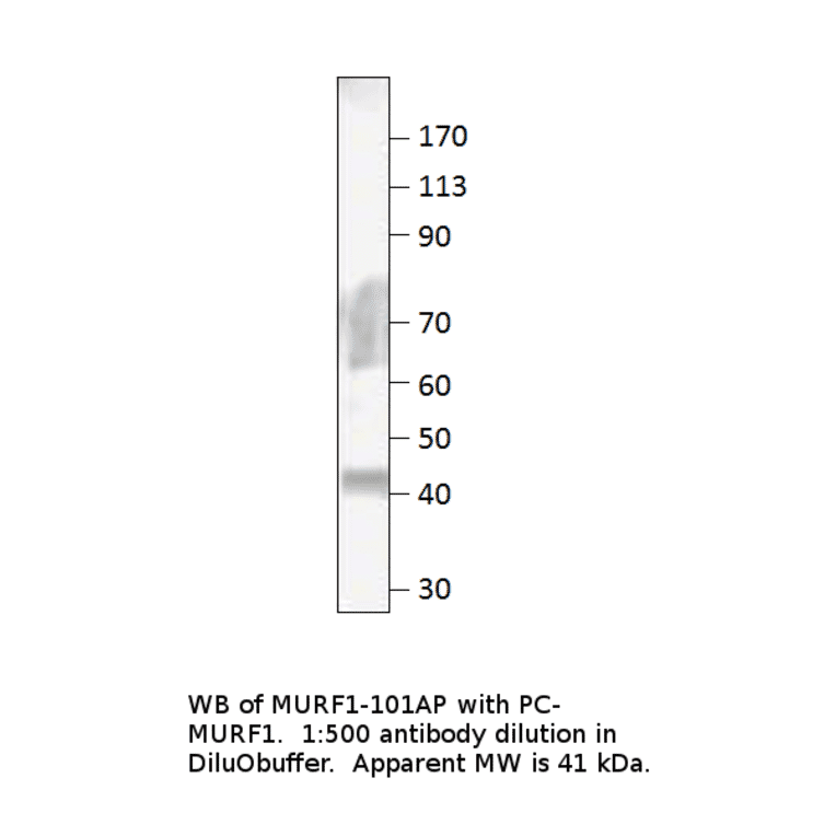 Anti-MURF1 Antibody from FabGennix (MURF1-101AP) - Antibodies.com