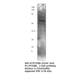 Anti-MyD88 Antibody from FabGennix (MYD88-101AP) - Antibodies.com