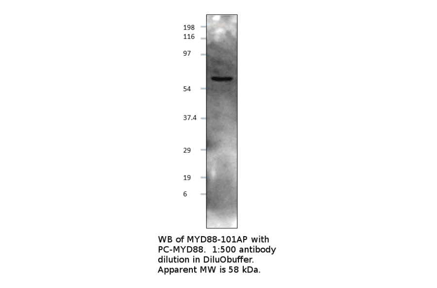 Anti-MyD88 Antibody from FabGennix (MYD88-101AP) - Antibodies.com