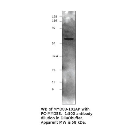 Anti-MyD88 Antibody from FabGennix (MYD88-101AP) - Antibodies.com