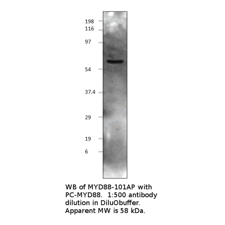 Anti-MyD88 Antibody from FabGennix (MYD88-101AP) - Antibodies.com