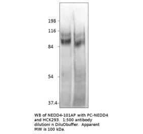 Anti-NEDD4 Antibody from FabGennix (NEDD4-101AP) - Antibodies.com