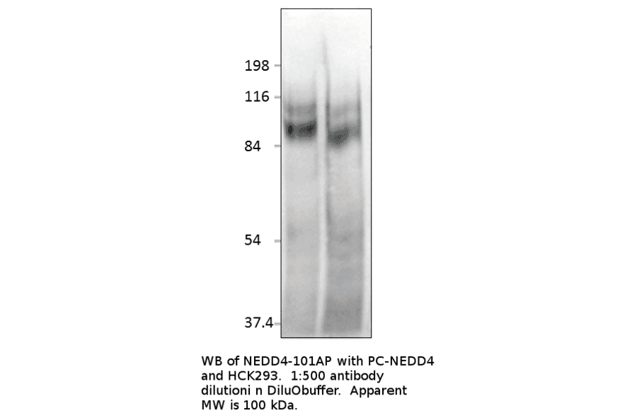 Anti-NEDD4 Antibody from FabGennix (NEDD4-101AP) - Antibodies.com