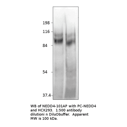 Anti-NEDD4 Antibody from FabGennix (NEDD4-101AP) - Antibodies.com