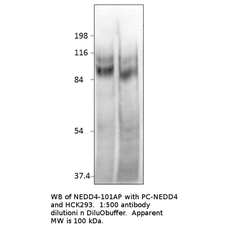 Anti-NEDD4 Antibody from FabGennix (NEDD4-101AP) - Antibodies.com