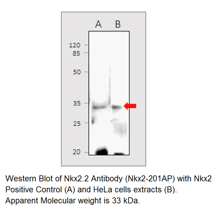 Anti-Nkx2.2 Antibody from FabGennix (NKX2-201AP) - Antibodies.com