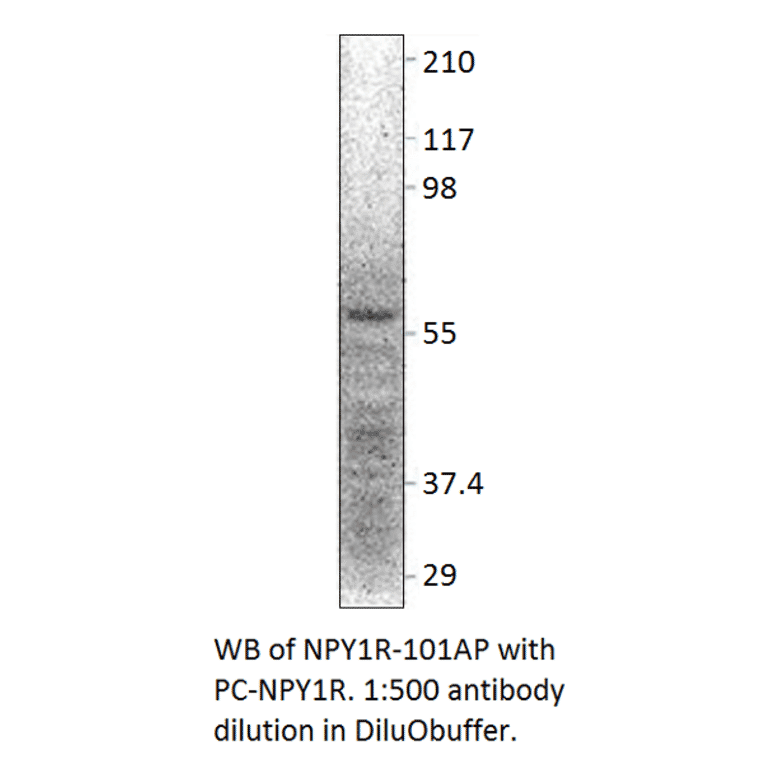 Anti-NPY1R Antibody from FabGennix (NPY1R-101AP) - Antibodies.com