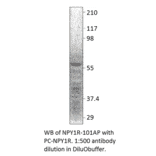 Anti-NPY1R Antibody from FabGennix (NPY1R-101AP) - Antibodies.com