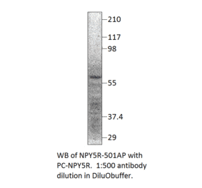 Anti-NPY5R Antibody from FabGennix (NPY5R-501AP) - Antibodies.com