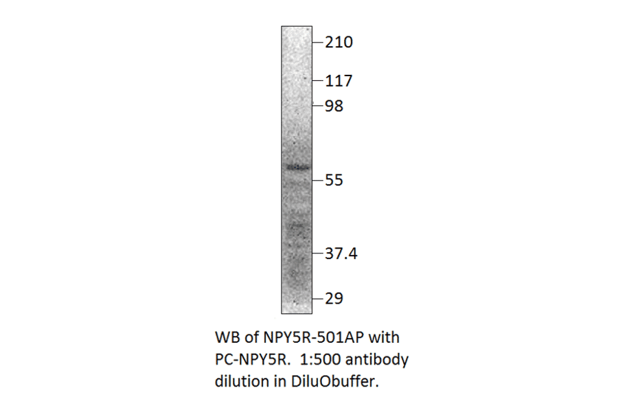 Anti-NPY5R Antibody from FabGennix (NPY5R-501AP) - Antibodies.com